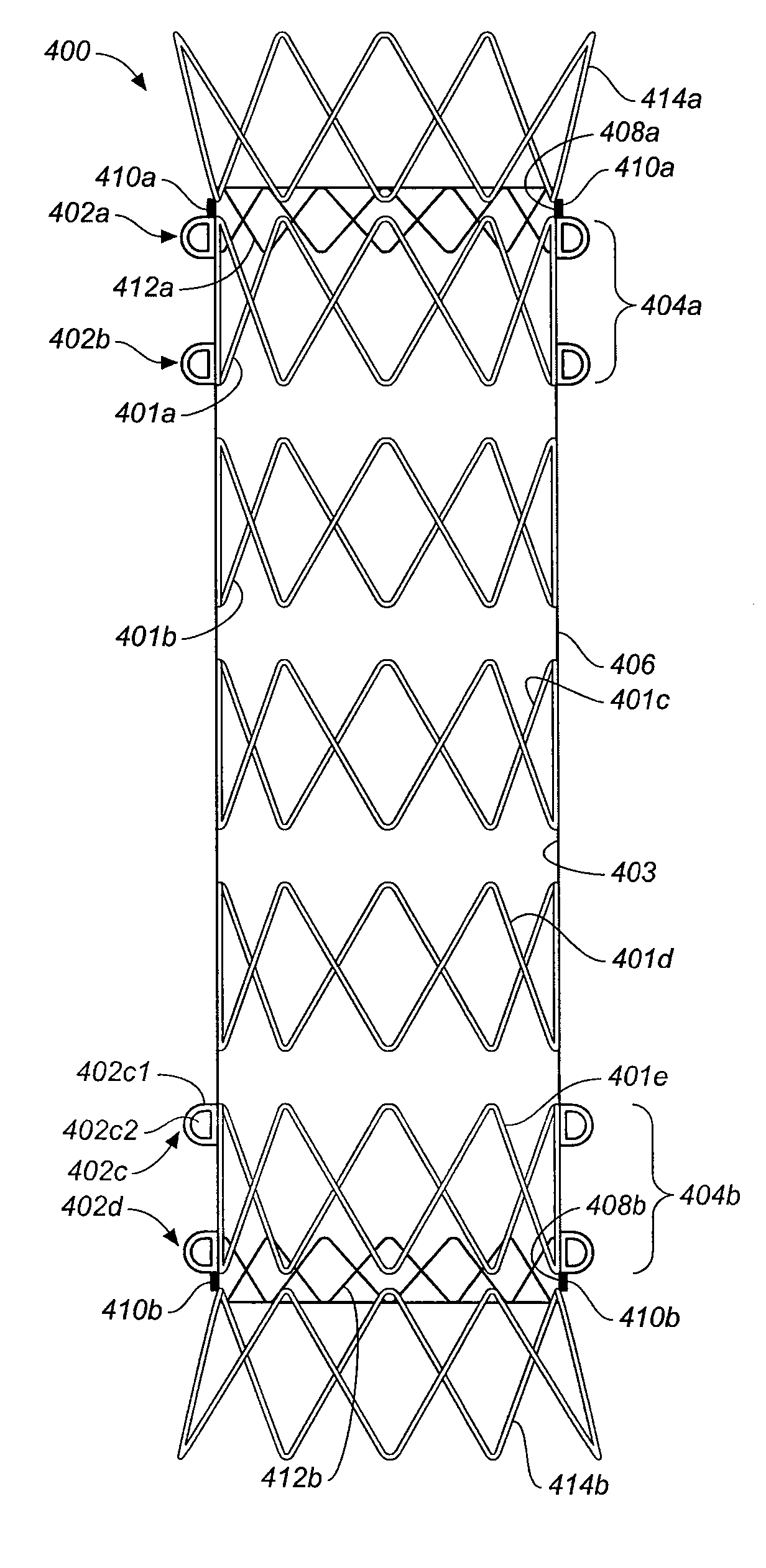 Prosthesis With Coupling Zone and Methods