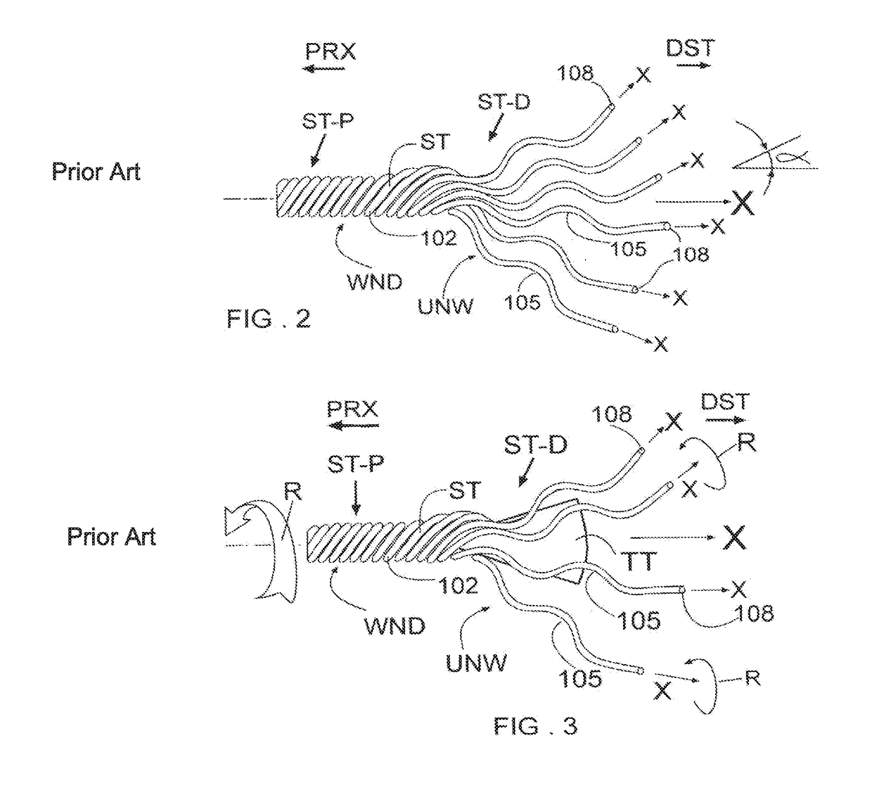 Method system and fastener for anchoring a corpu