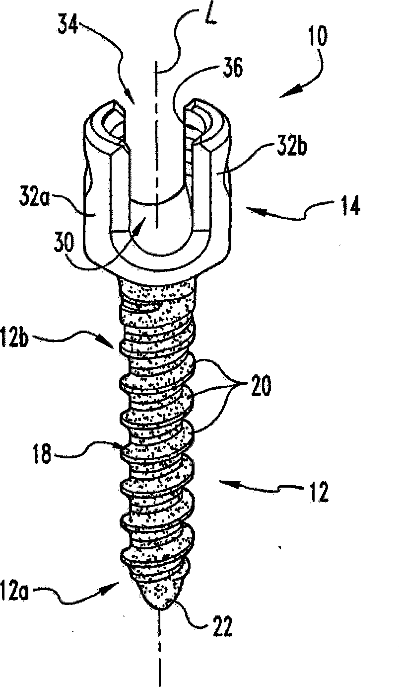 Bone anchors and methods of forming the same