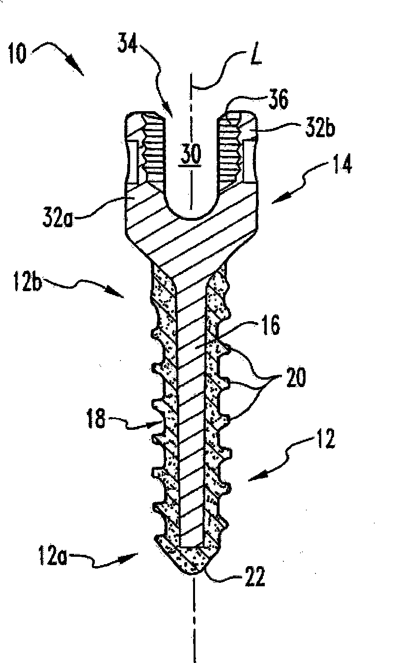 Bone anchors and methods of forming the same