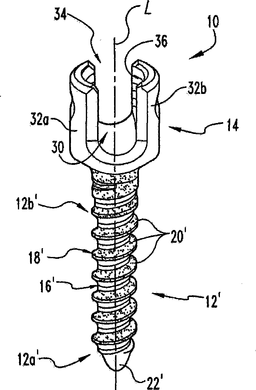 Bone anchors and methods of forming the same