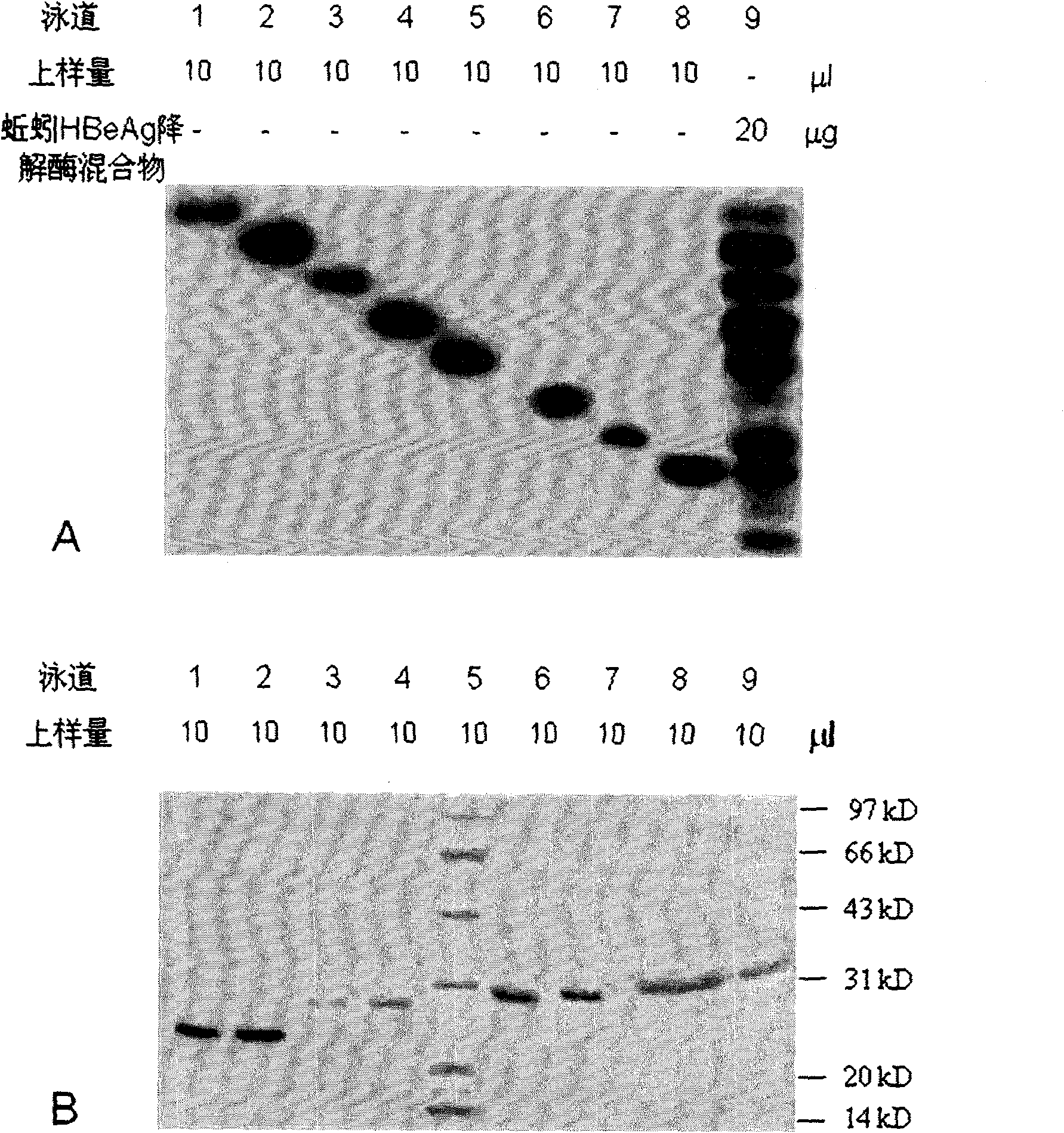 Earthworm protein with HBeAg degrading enzyme activity and application thereof