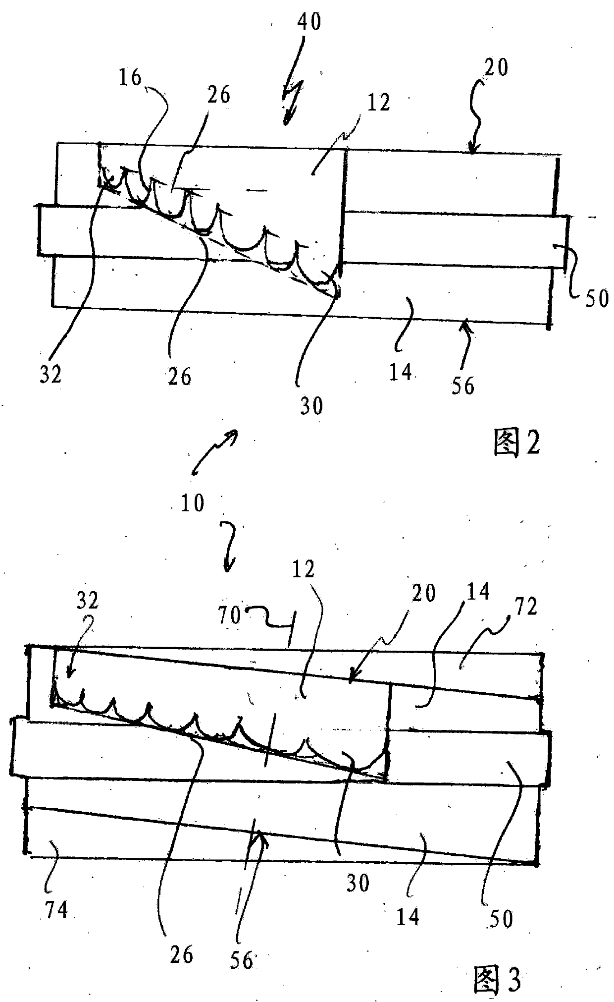 Dental prosthesis