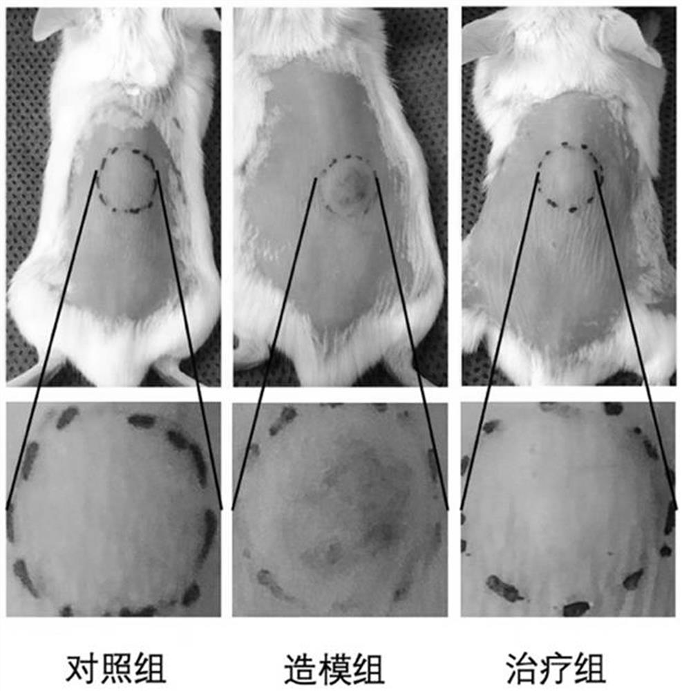 Chemotactic factor as molecular marker for diagnosing rosacea