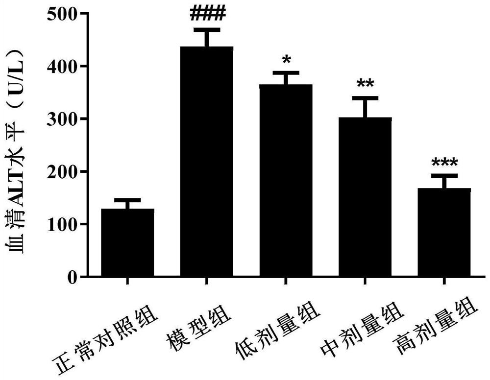 A kind of traditional Chinese medicine compound preparation for treating liver fibrosis and its preparation method and application