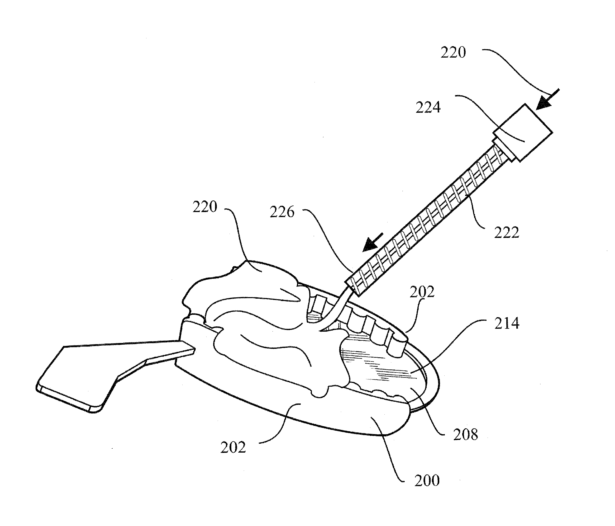 Method and system of making dental impressions