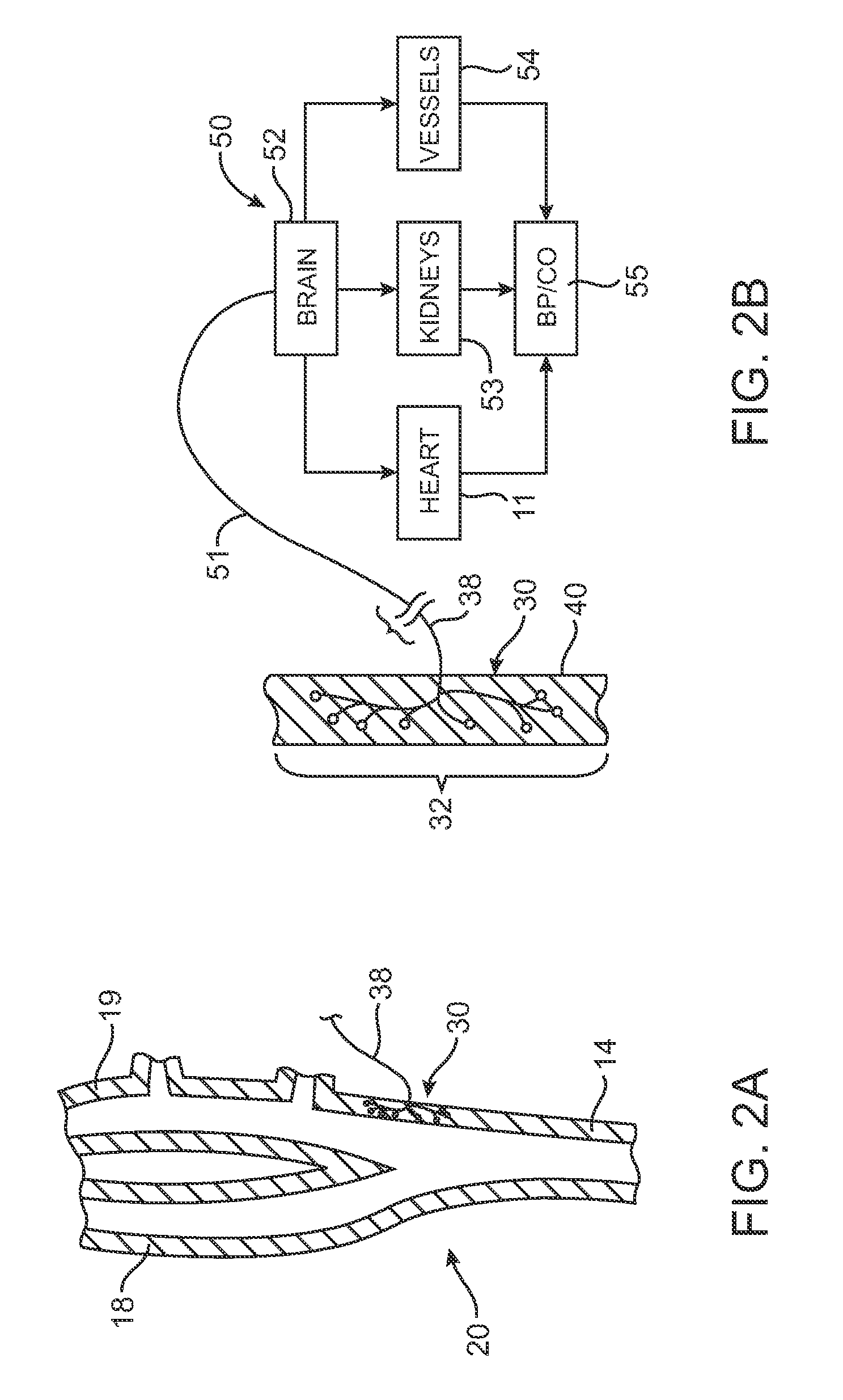 Electrode array structures and methods of use for cardiovascular reflex control