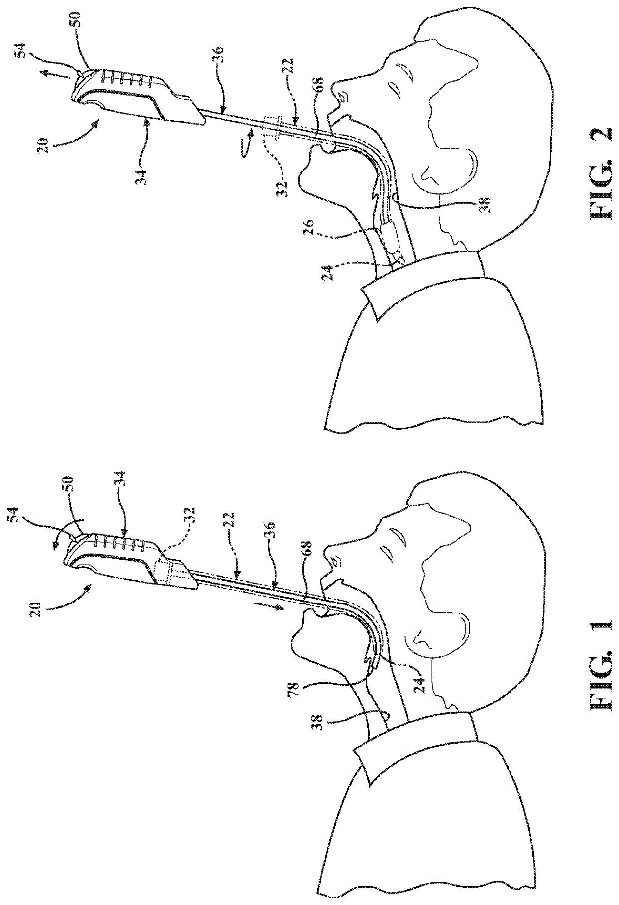 Intubation stylet with video feed