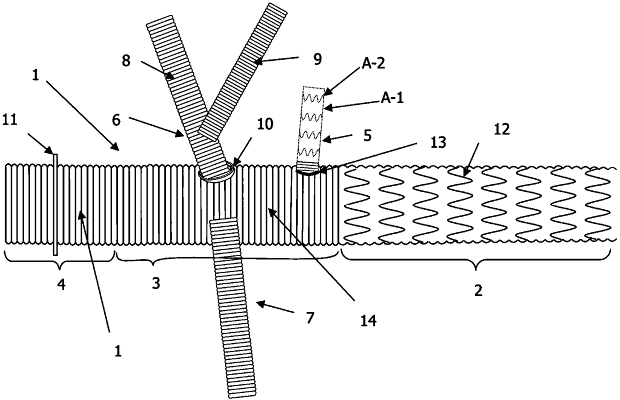Built-in device for individualized branch stent type arch part reconstructed artificial blood vessel