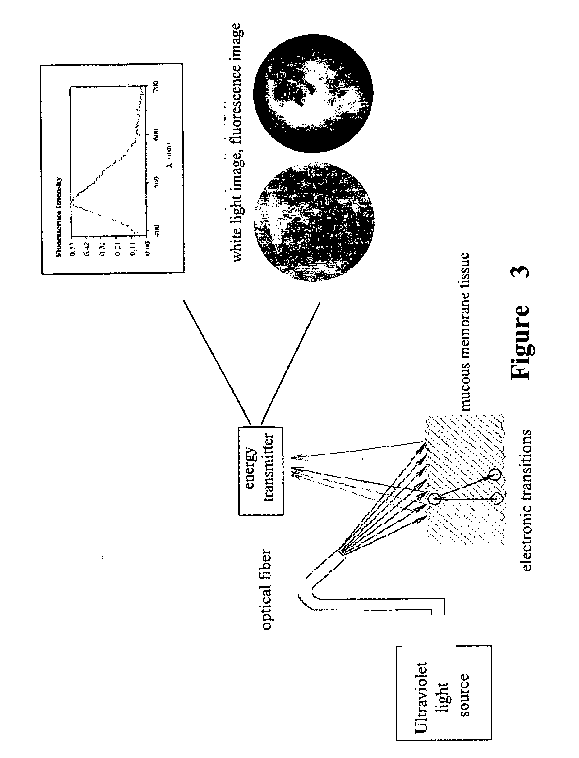 Optical biopsy method for precancerous lesion diagnosis and an endoscope apparatus thereof