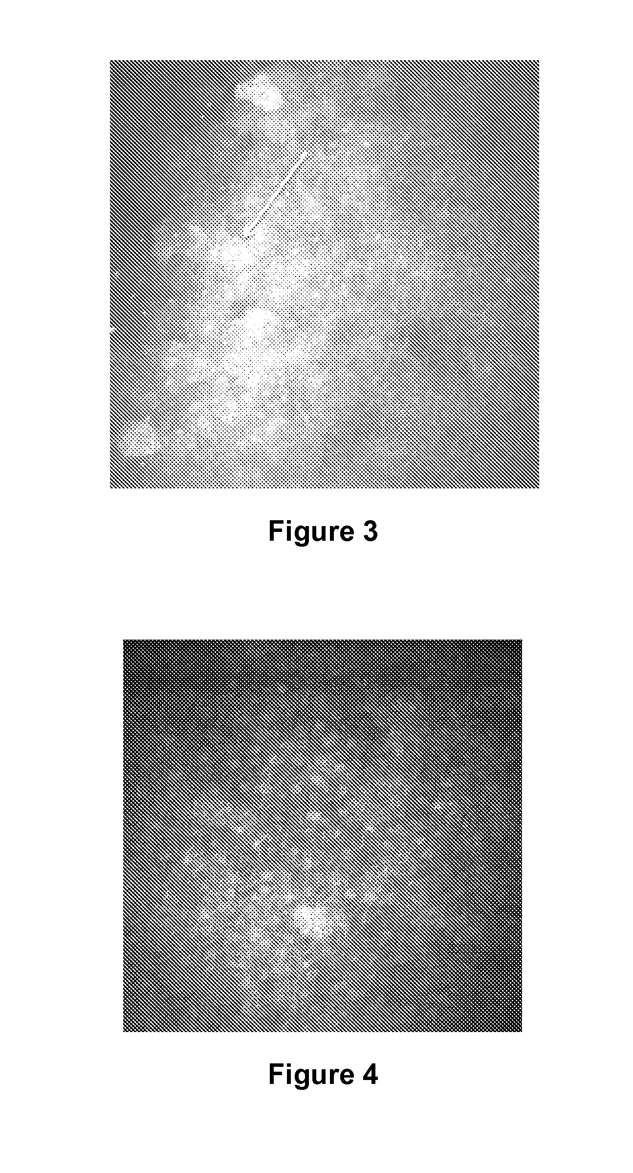 Inflammatory eye disorders