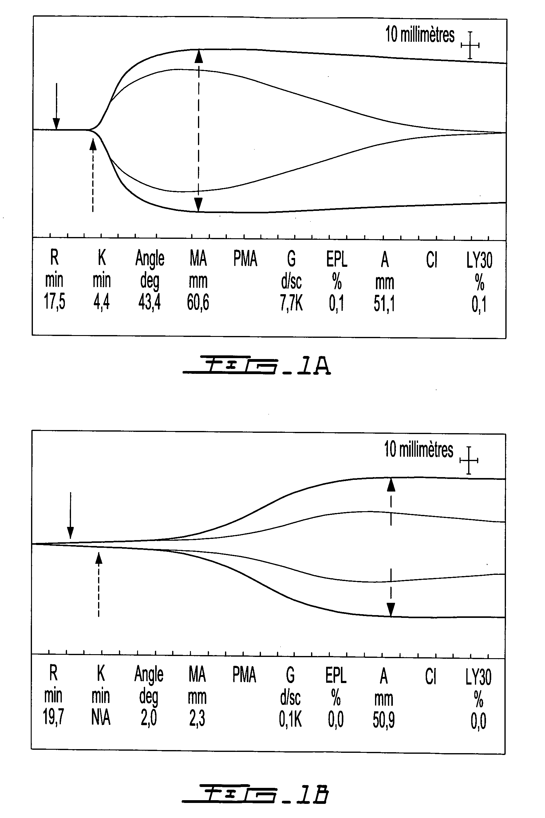 Method for in situ solidification of blood-polymer compositions for regenerative medicine and cartilage repair applications