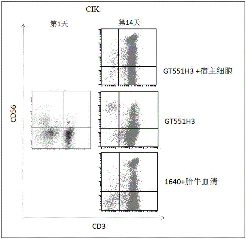 Method for amplifying and activating LAK cells by non-fetus bovine serum