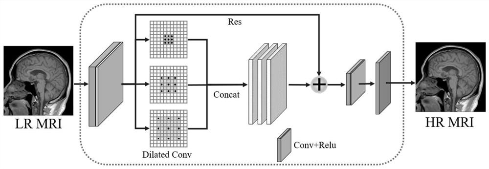 Magnetic resonance reconstruction method of super-resolution convolutional neural network based on cavity convolution