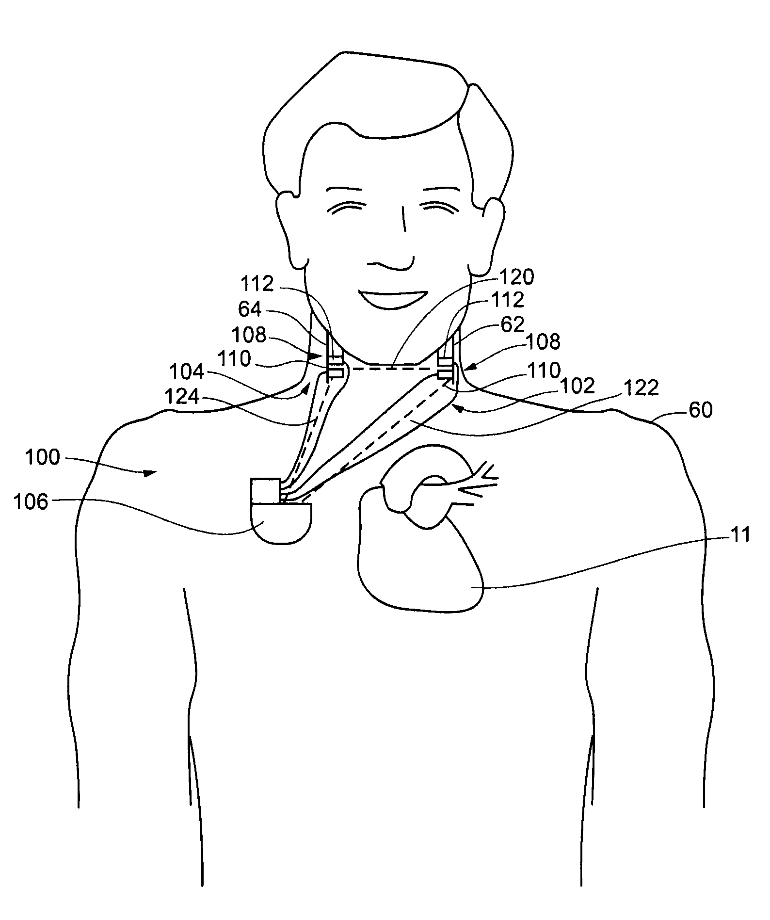 Method for monitoring physiological cycles of a patient to optimize patient therapy