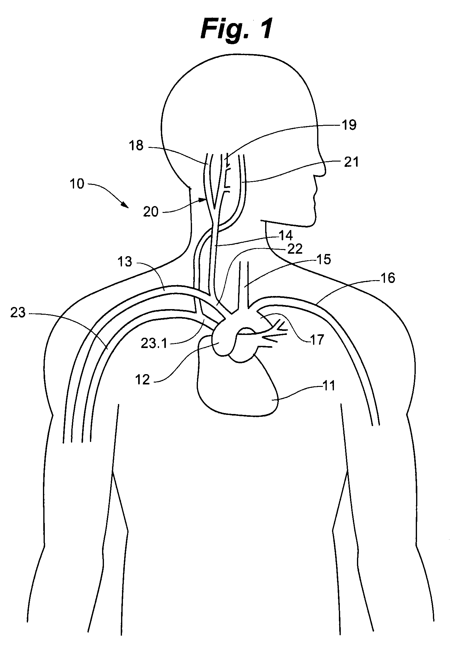 Method for monitoring physiological cycles of a patient to optimize patient therapy