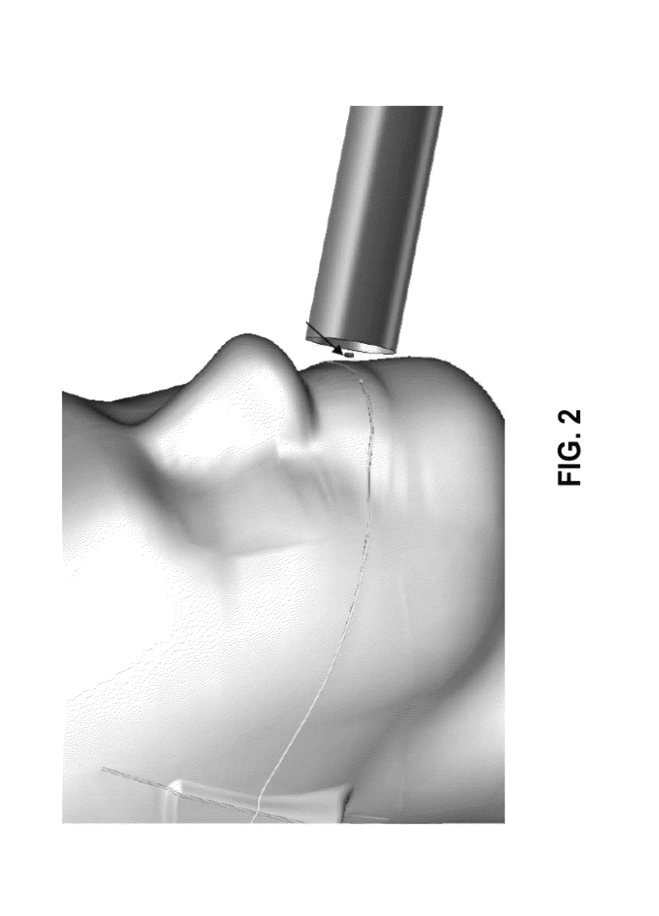 Method and device of estimating a dose of ionizing radiation