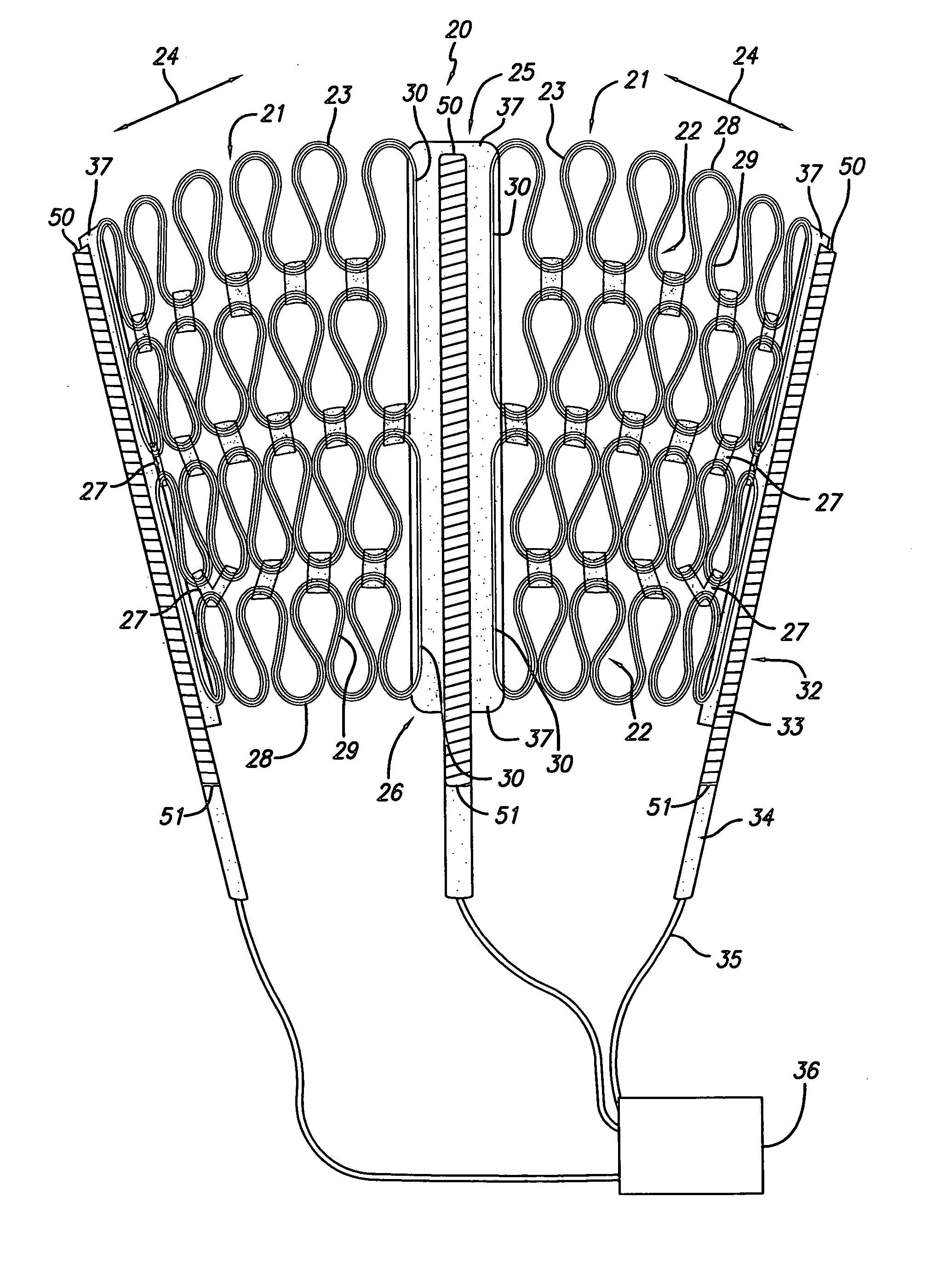Cardiac harness having leadless electrodes for pacing and sensing therapy