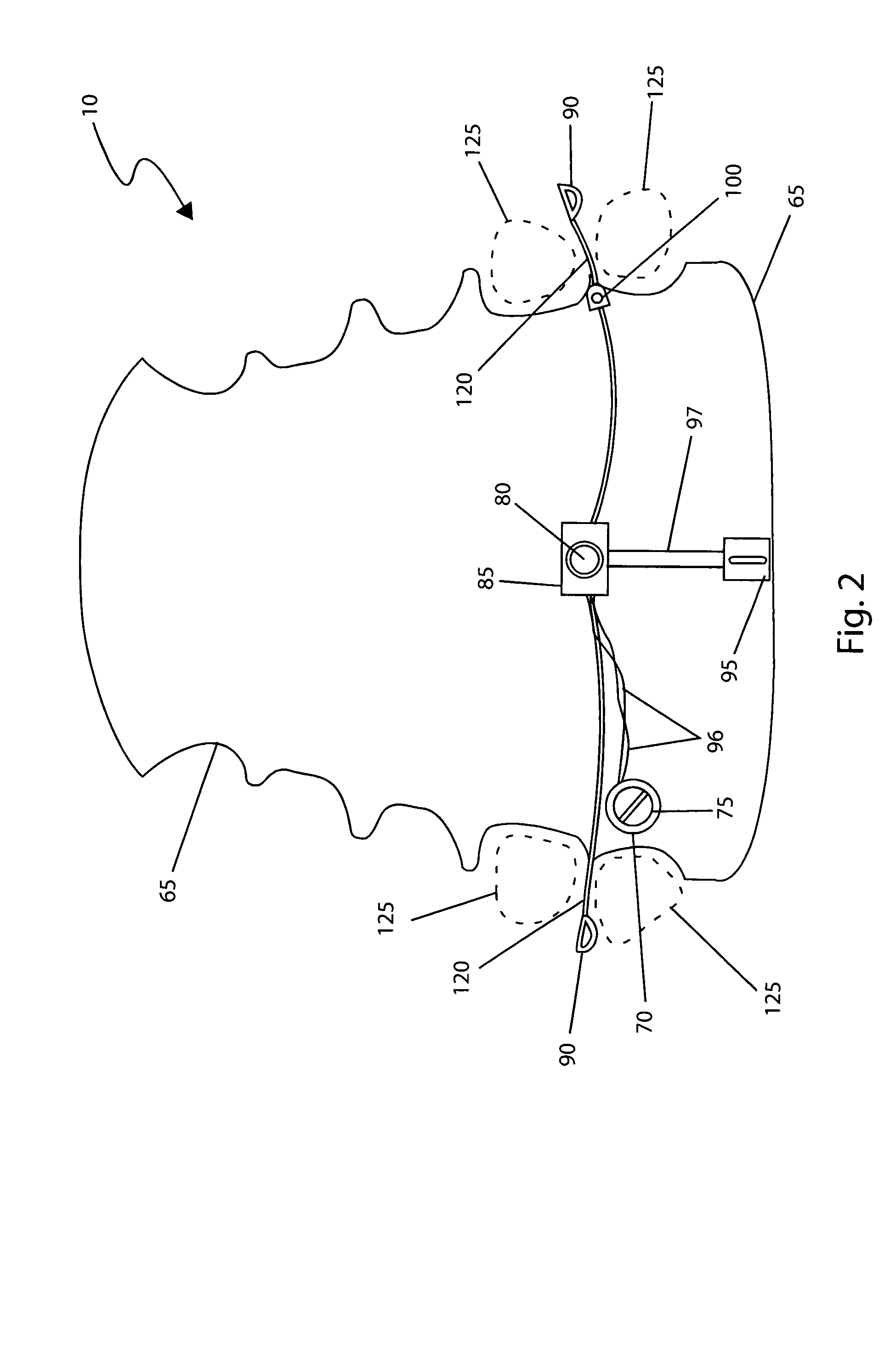Oral hearing aid device and method of use thereof