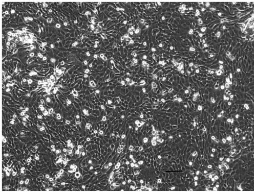 Separation method of human placenta sub-totipotent stem cells