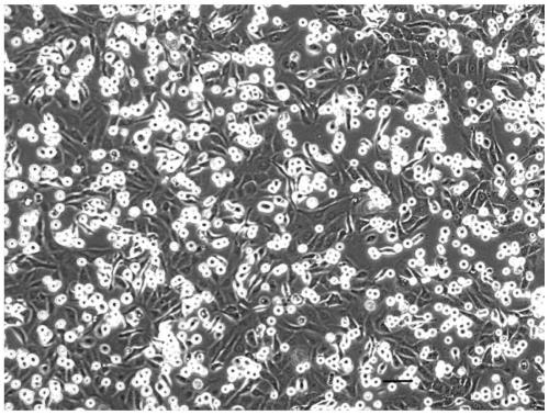 Separation method of human placenta sub-totipotent stem cells