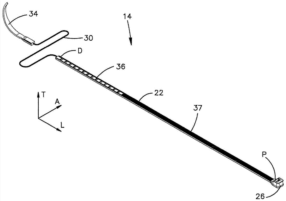 Bone fixation member systems and methods of use