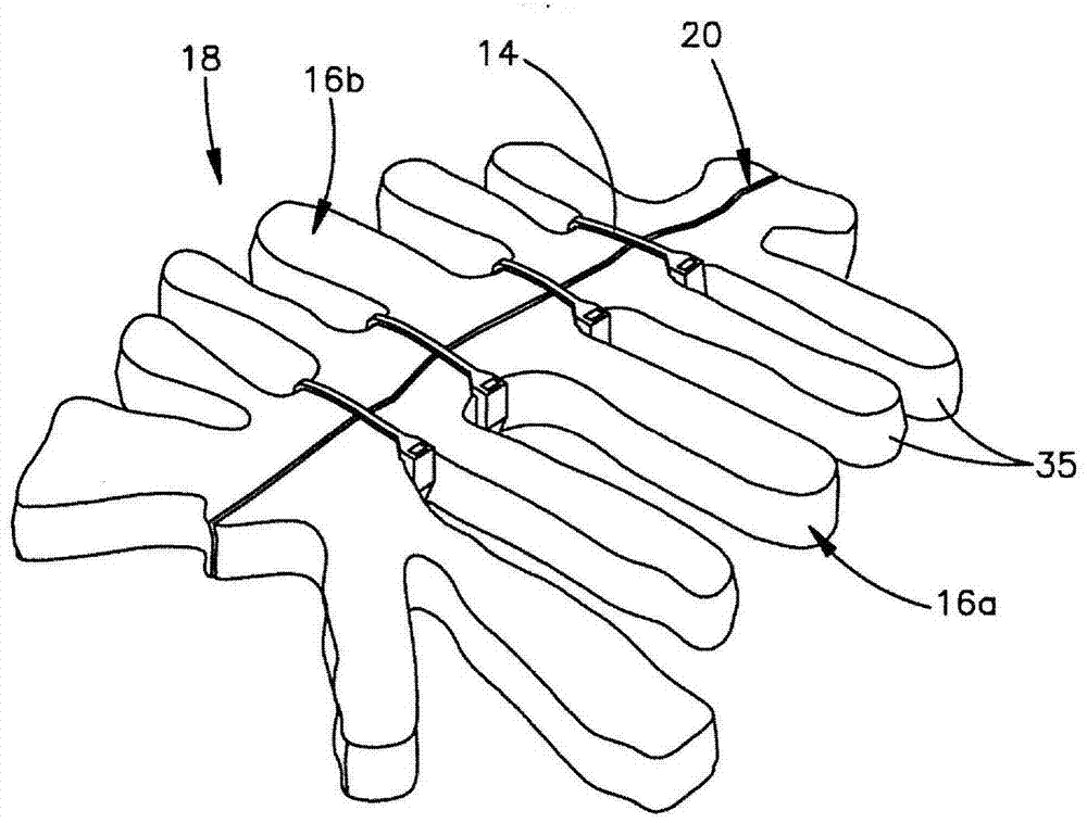 Bone fixation member systems and methods of use