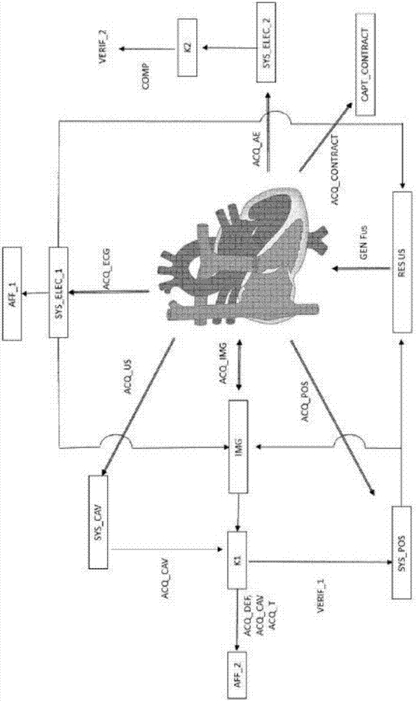 System for the ablation or the monitoring of a zone of the heart by ultrasounds and associated methods