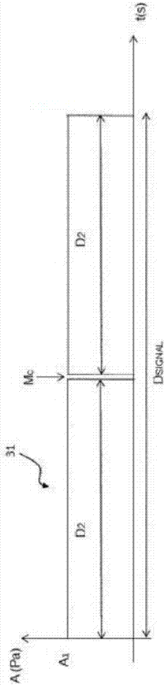 System for the ablation or the monitoring of a zone of the heart by ultrasounds and associated methods