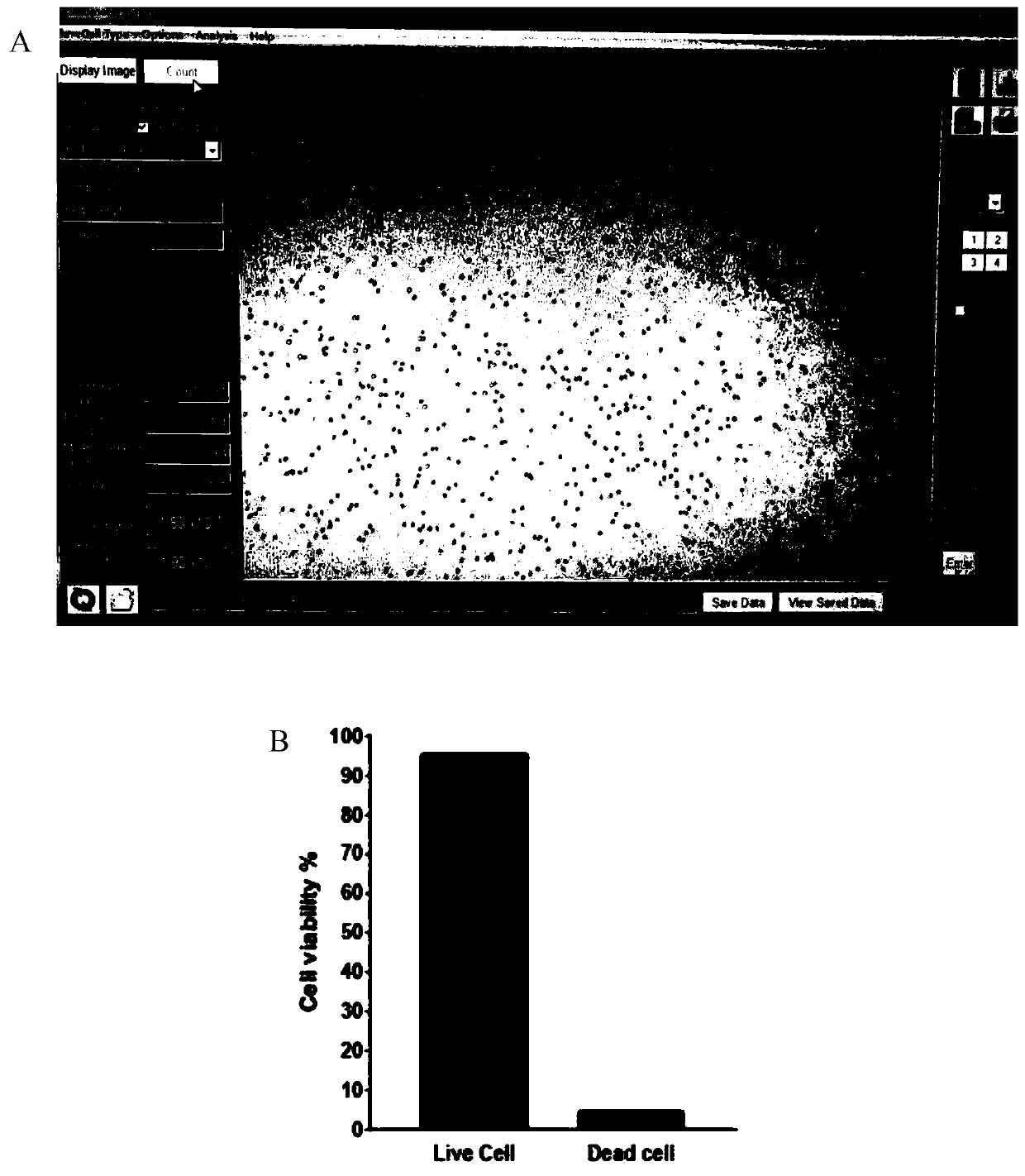 Preparation method and detection method of human parathyroid gland single-cell suspension