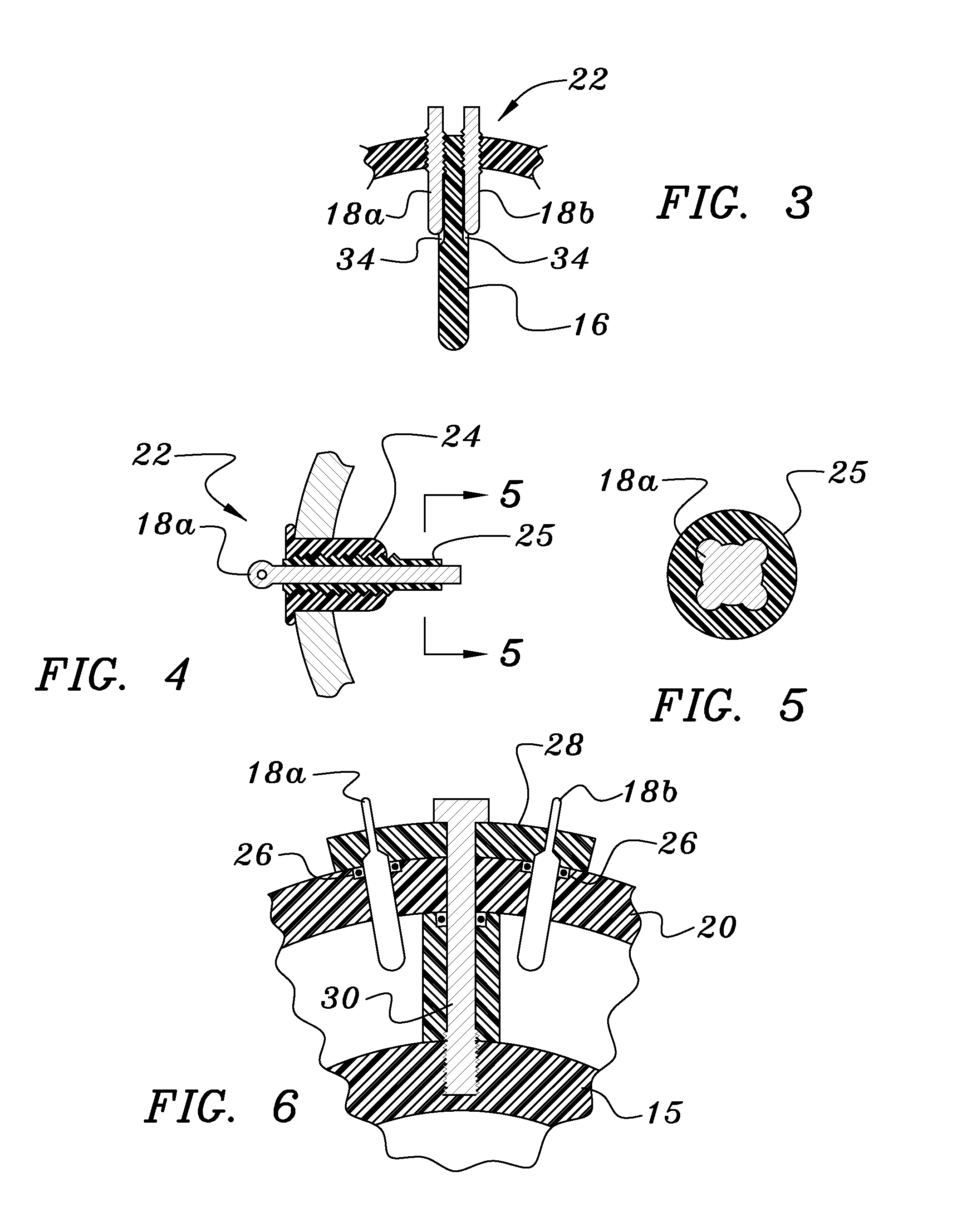 Magnetic flow meter with selective electrode positioning