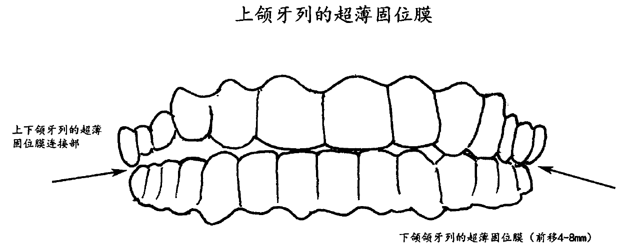 Manufacturing method and application of pressed film material functional appliance