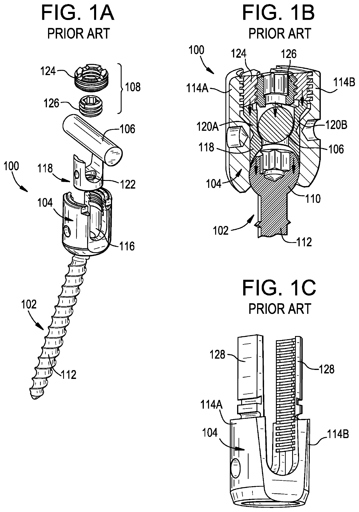 Multipoint fixation implants and related methods