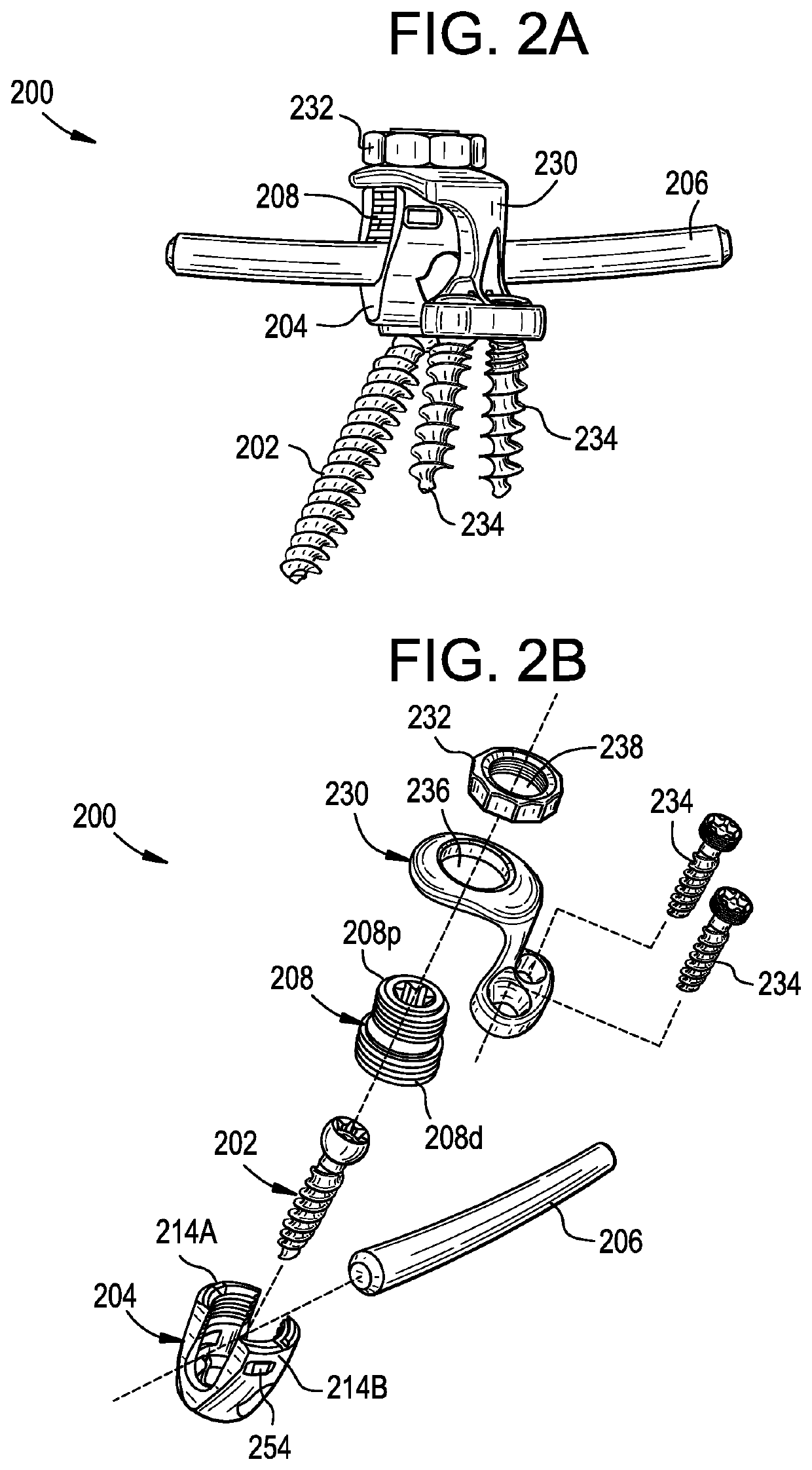 Multipoint fixation implants and related methods