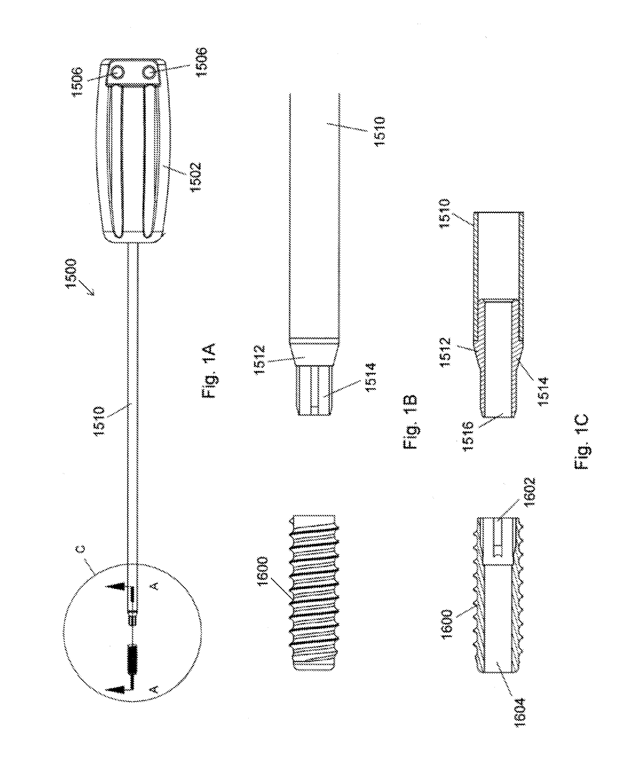 Ceramic implant placement systems and superelastic suture retention loops for use therewith