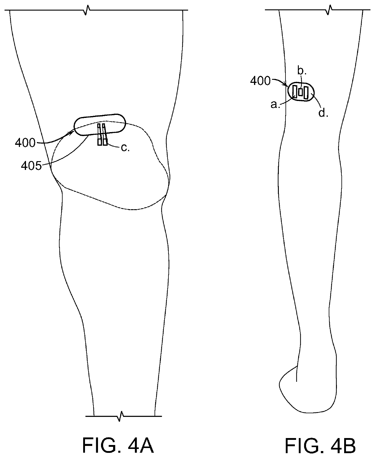 Transdermal Optogenetic Peripheral Nerve Stimulation