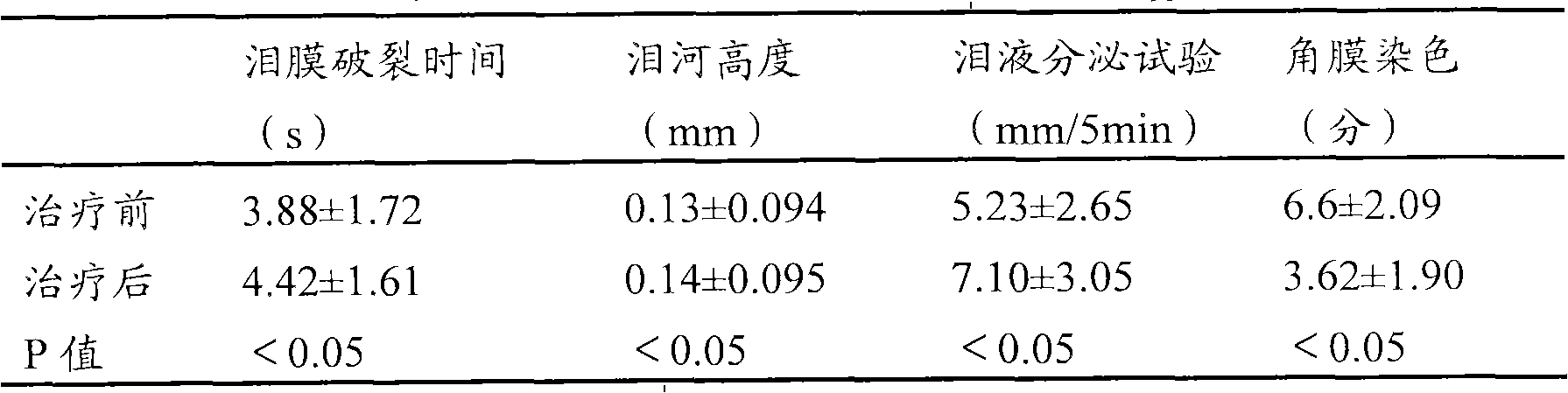 External traditional Chinese medicine composition for treating xerophthalmia and preparation method thereof