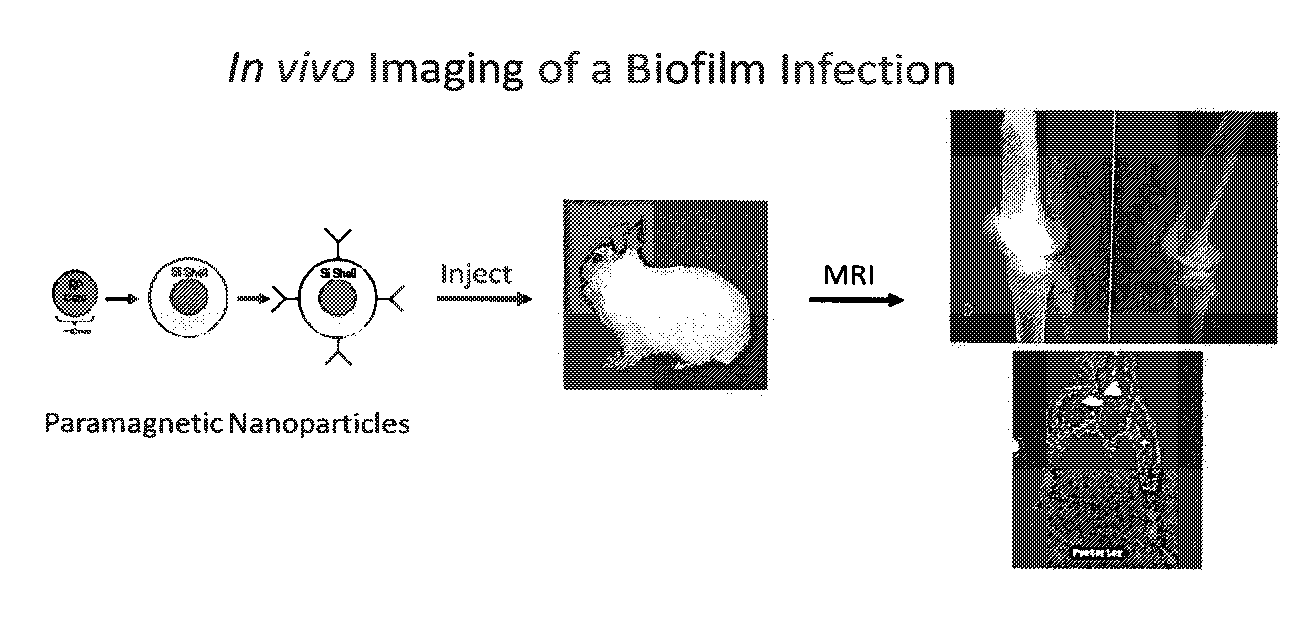 In Vivo Biofilm Infection Diagnosis and Treatment