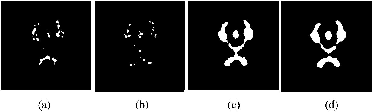 A Simultaneous Reconstruction Method of Dynamic PET Image and Tracer Kinetic Parameters Based on TV and Sparse Constraints