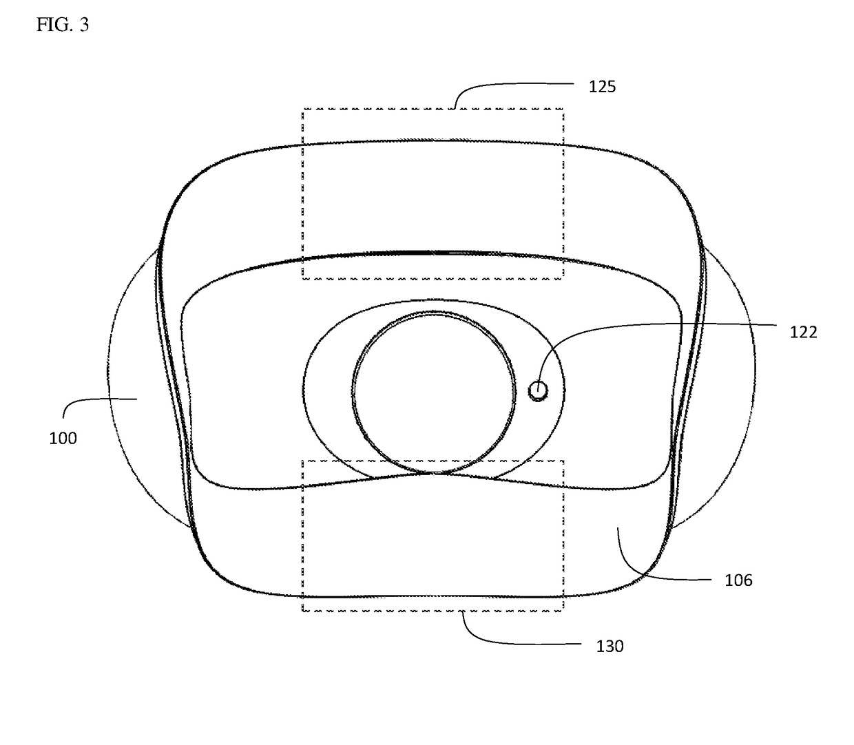 Device and method for opening an airway