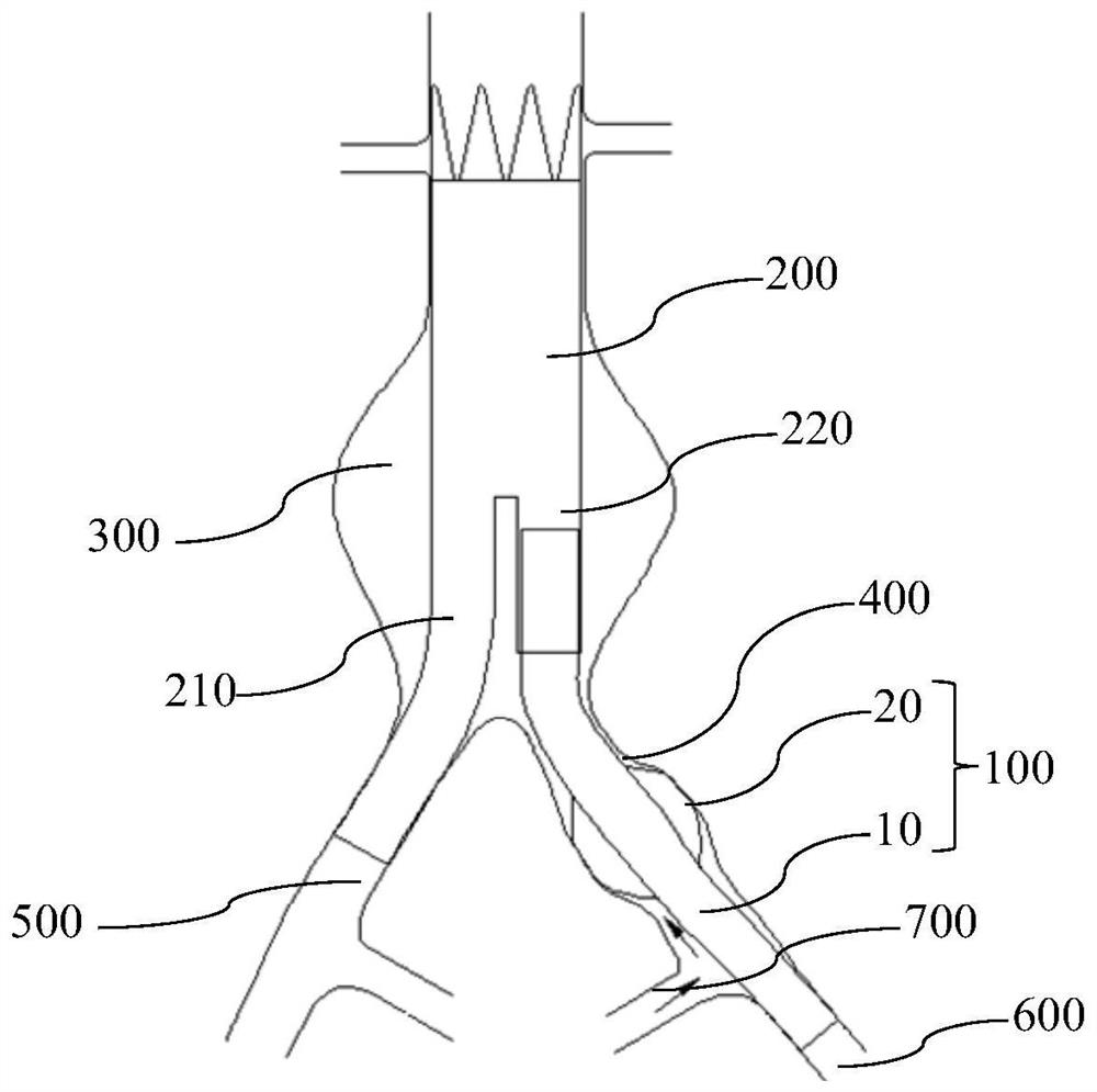 Covered stent