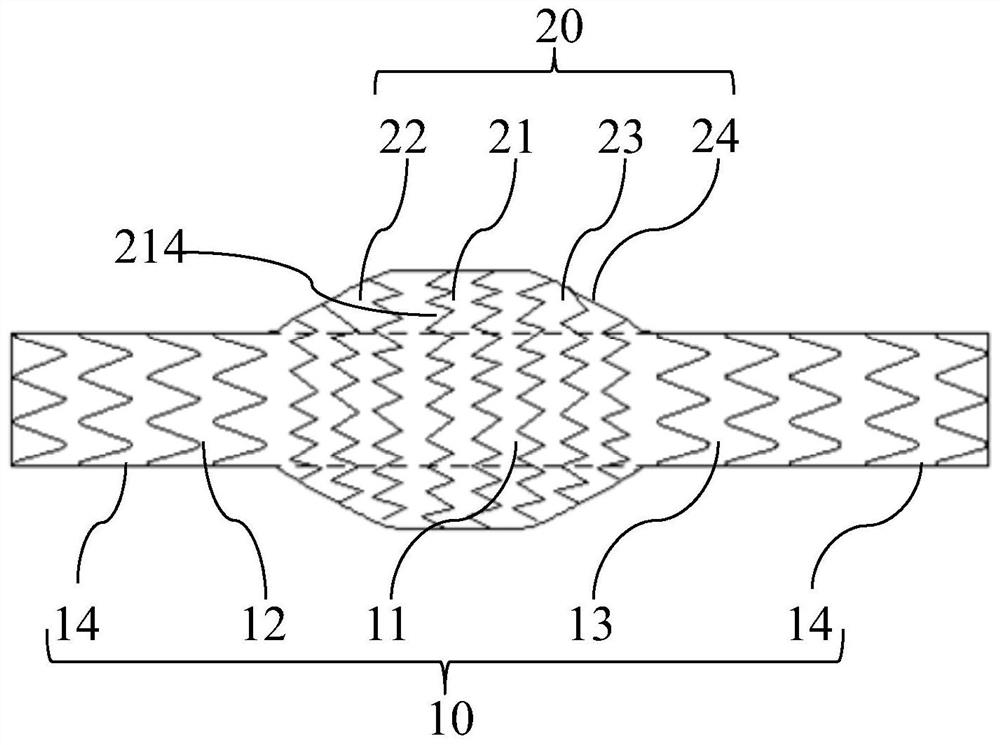 Covered stent