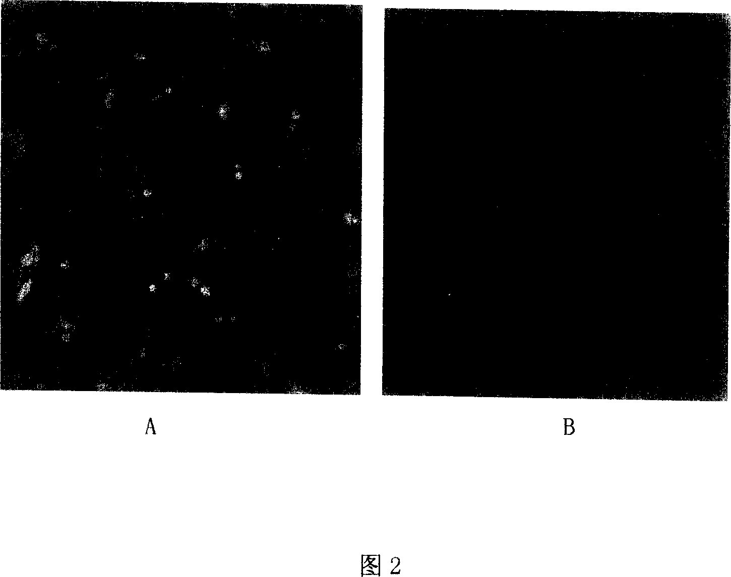 Targeted small interference RNA formulation for treating viral Hepatitis B and its preparation