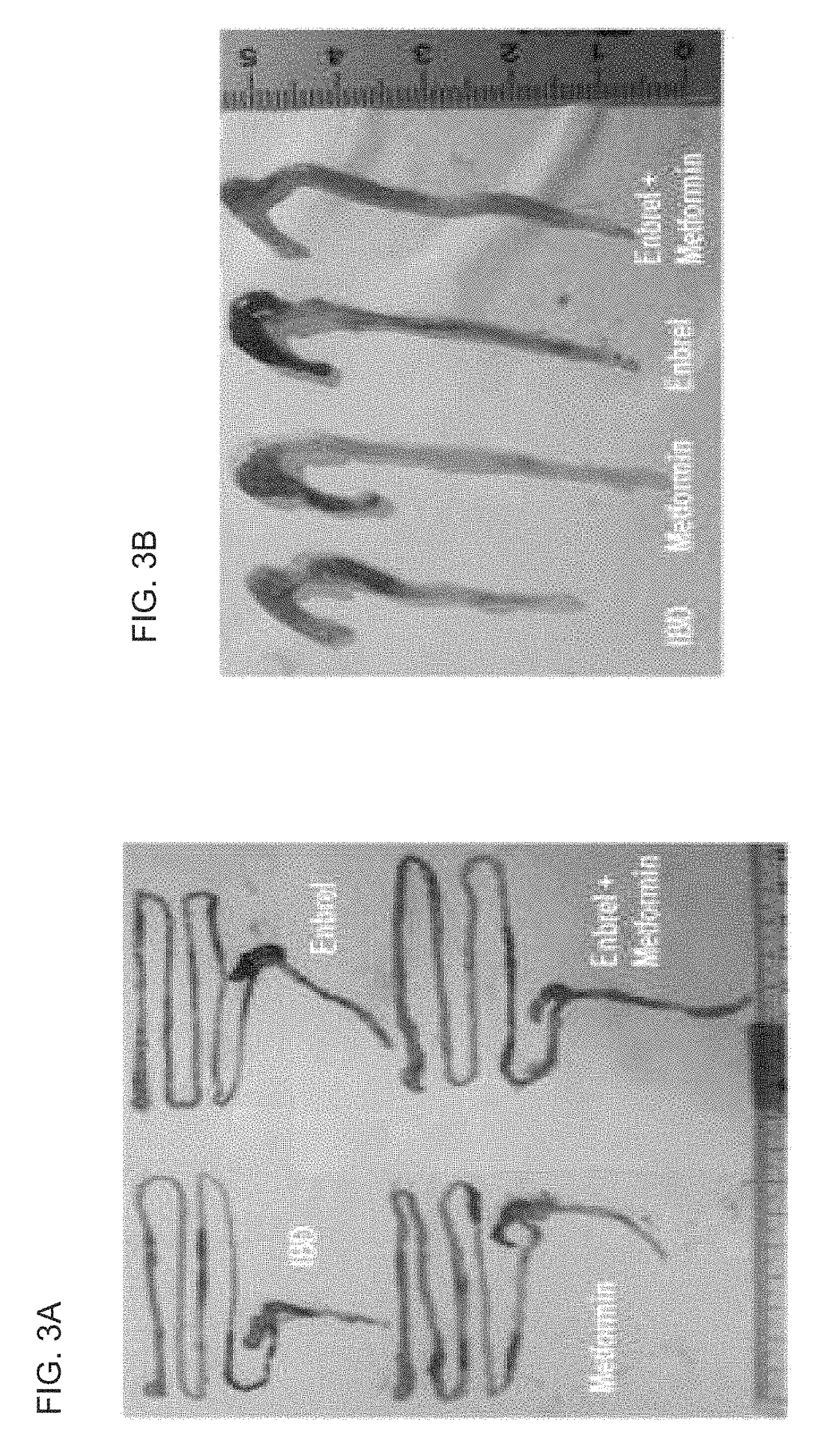 Composition comprising metformin as active ingredient for preventing or treating inflammatory bowel disease