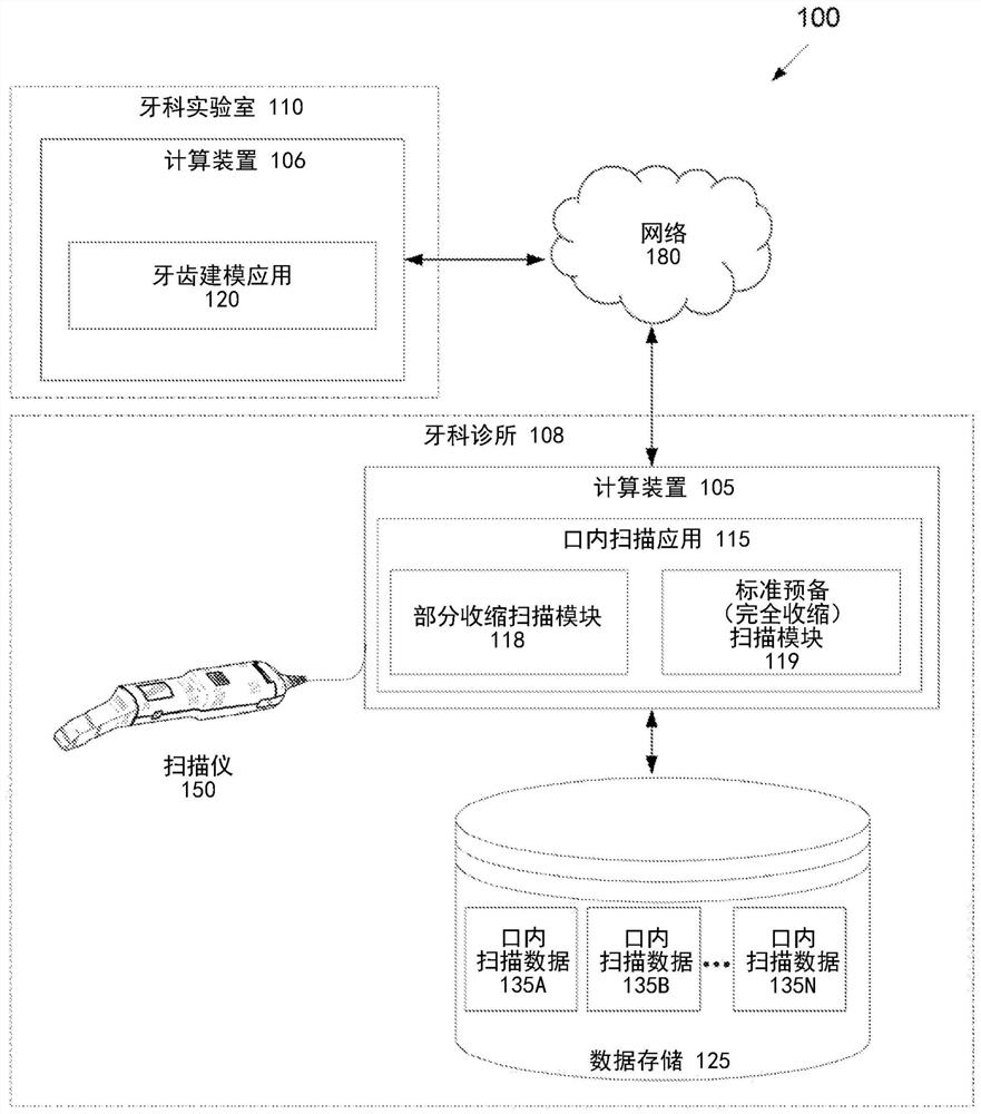 Automatic detection, generation and/or correction of tooth features in digital models