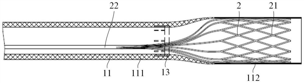 Suction catheter