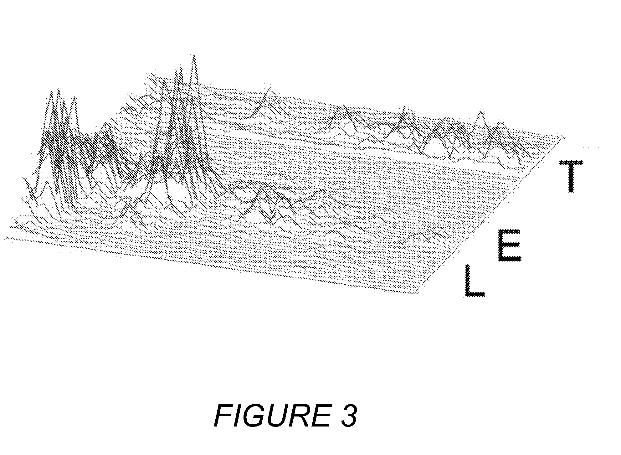 Adaptively filtering a microphone signal responsive to vibration sensed in a user's face while speaking