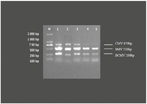 Primer for simultaneously detecting three viruses of CMV, SMV and BCMV in soybeans and detection method thereof