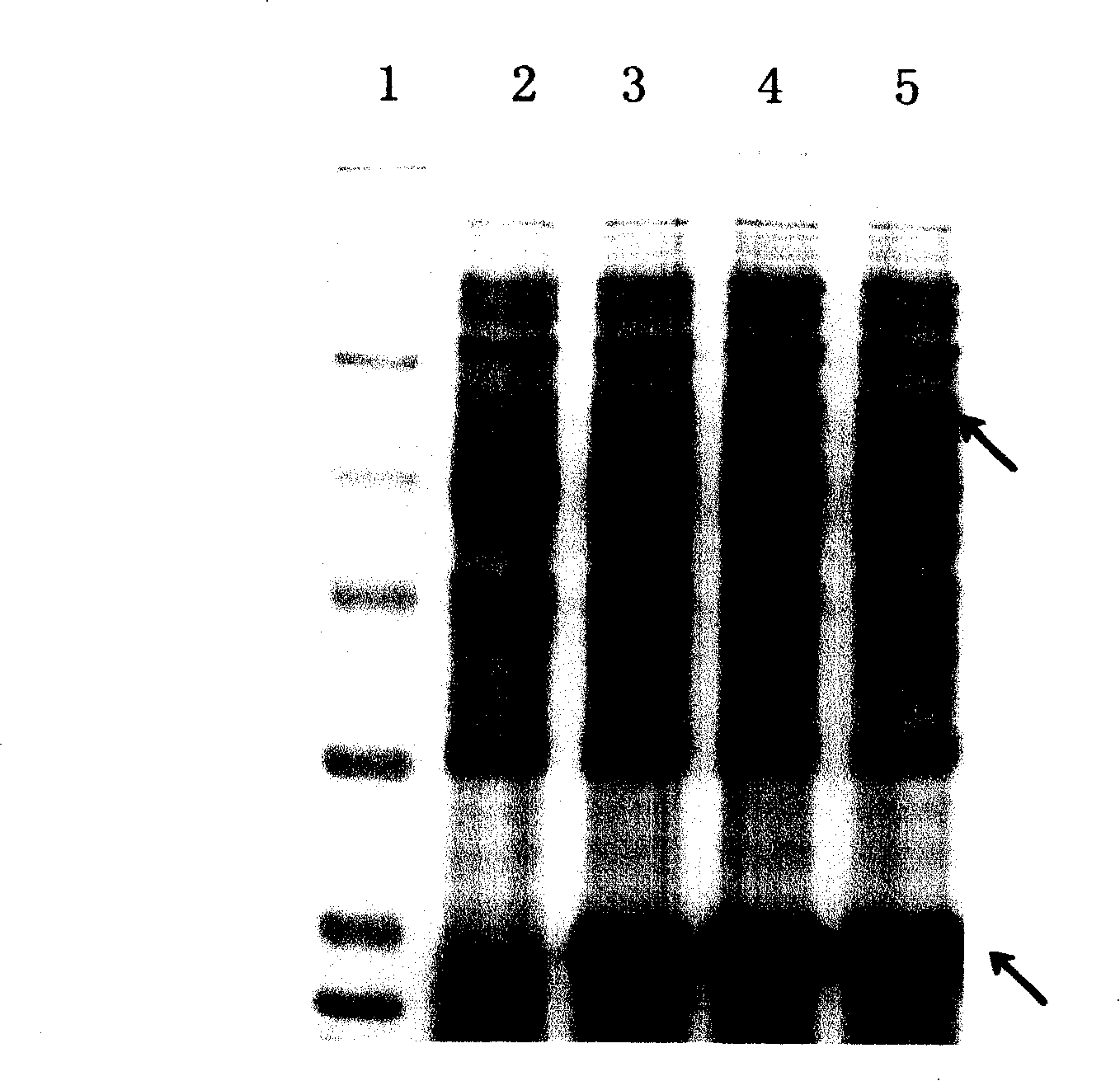 Technology for preparing active t-PA by procaryotic cells