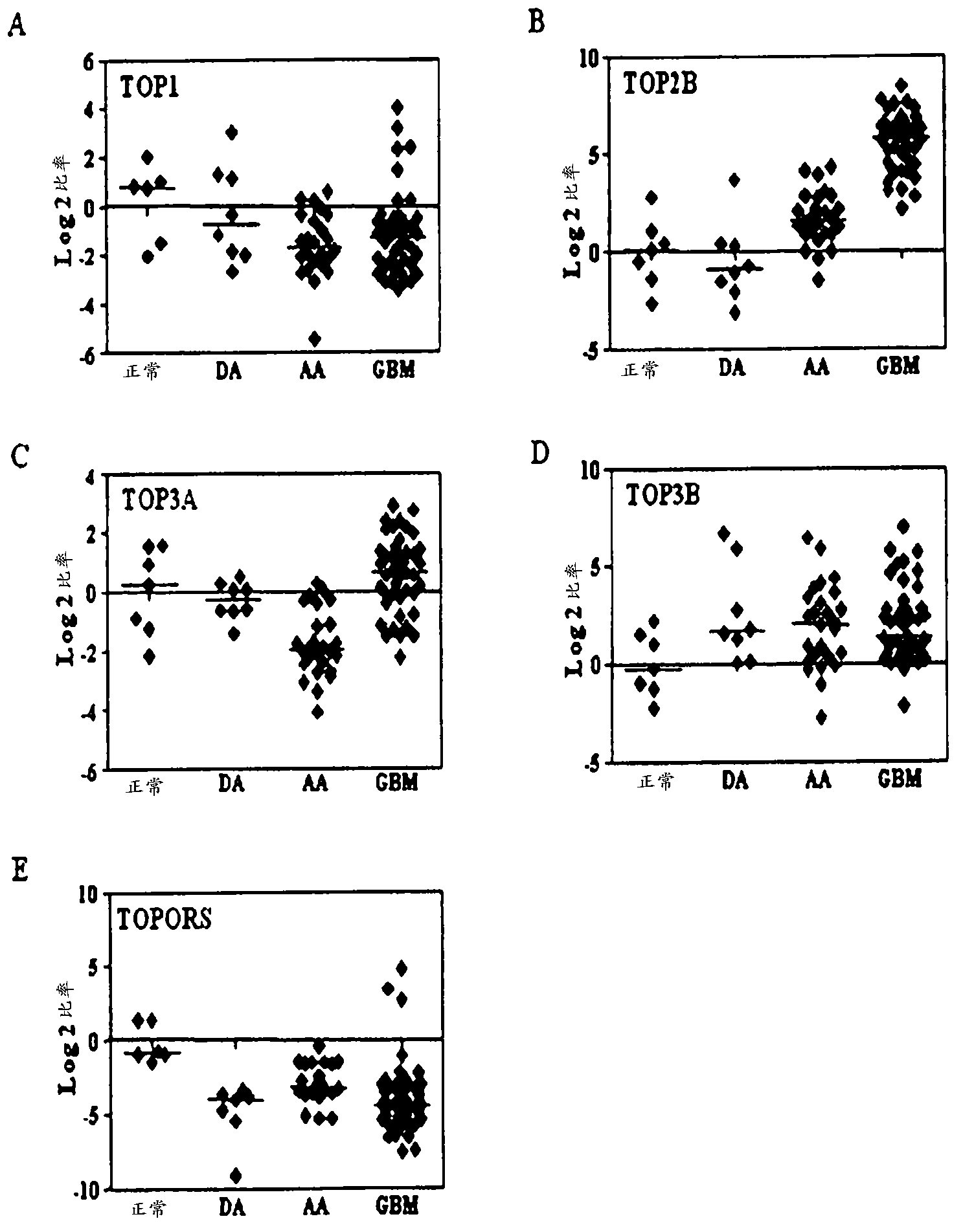 Top2a inhibition by temozolomide useful for predicting gbm patient's survival